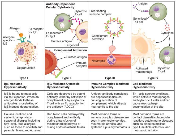 types of hypersensitivity reactions