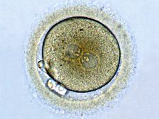 zygote