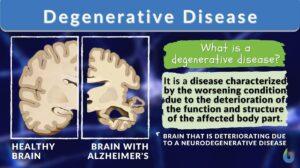 degenerative disease definition and example