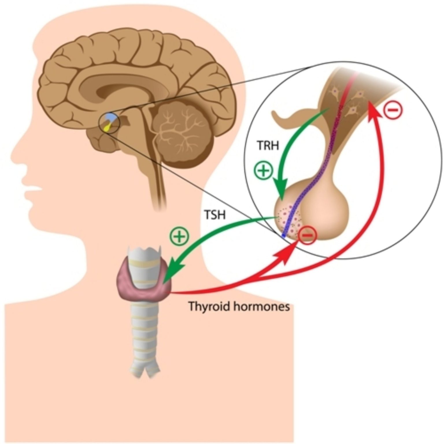 Atrophy Definition and Examples - Biology Online Dictionary