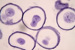 Cells in different stages of meiosis