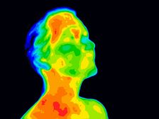 Thermographic image of face and neck