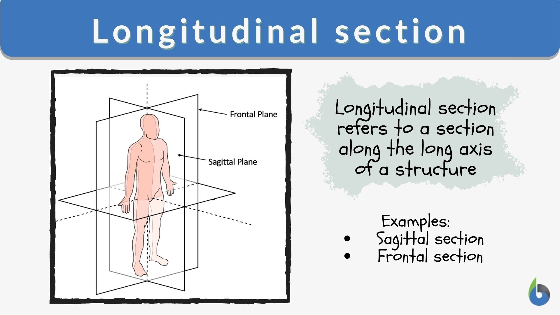 Longitudinal section - Definition and Examples - Biology Online