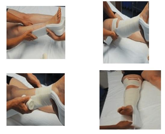 Application of Skin Traction