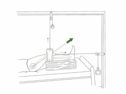 Russell Skeletal Traction