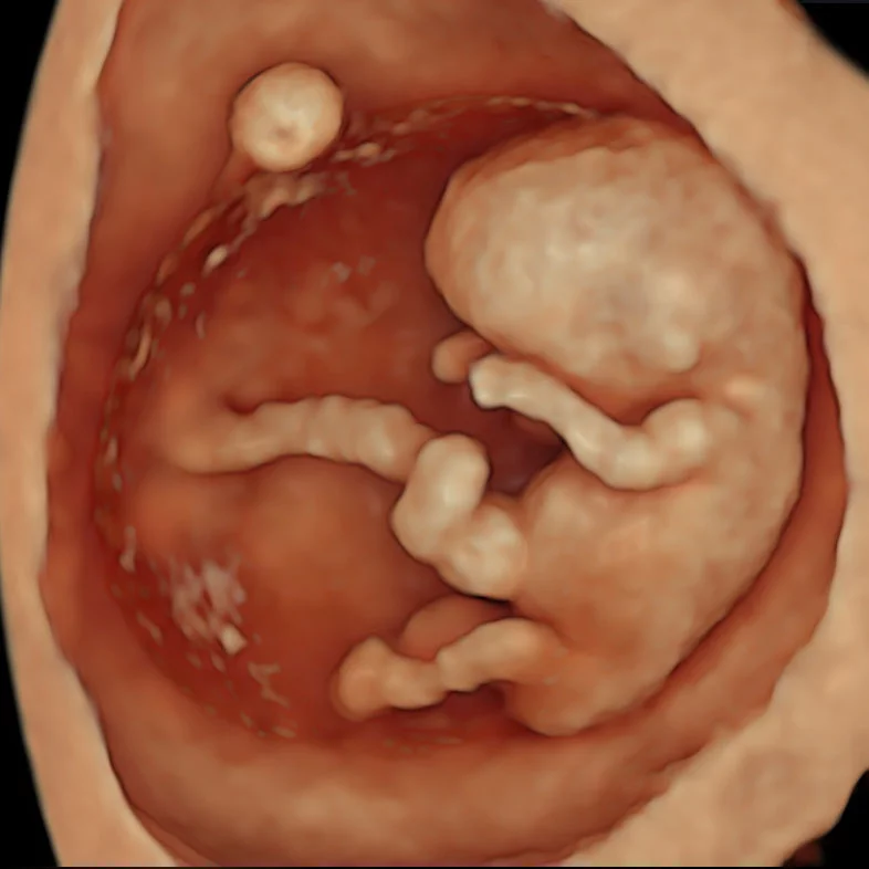 Fetus Definition And Examples Biology Online Dictionary the-spread-of-latin-and-major-romance-languages-maps-on-the-web