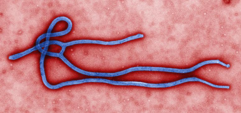 Ebola virus is a viral pathogen