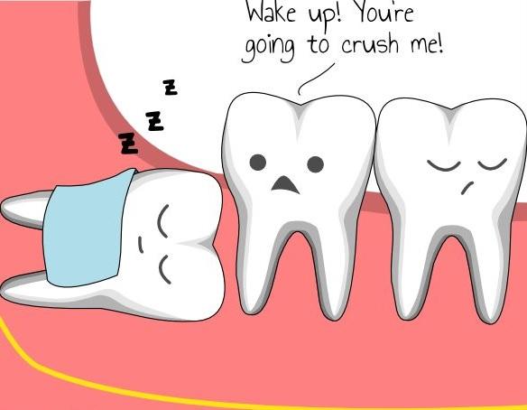 cartoon to show the nature of wisdom teeth
