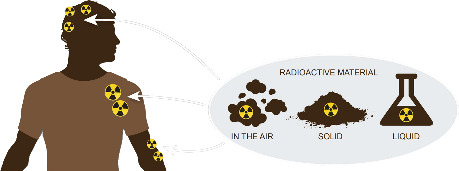 Internal radioactive contamination on a human