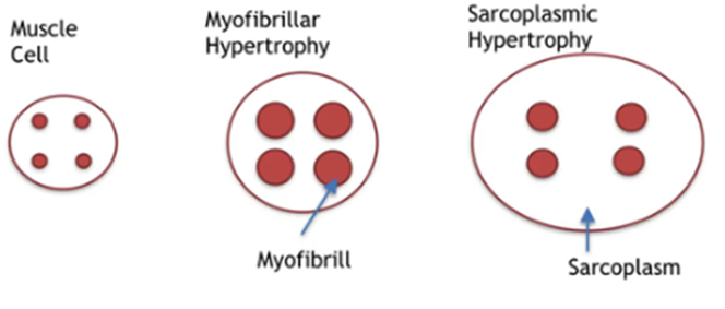 normal muscle, myofibrillar hypertrophy, sarcoplasmic hypertrophy