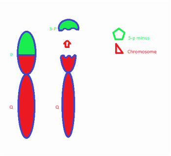 Cri du Chat syndrome - autosome 5