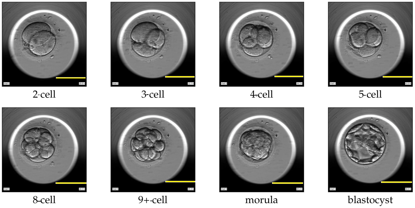 cell cleavage stages