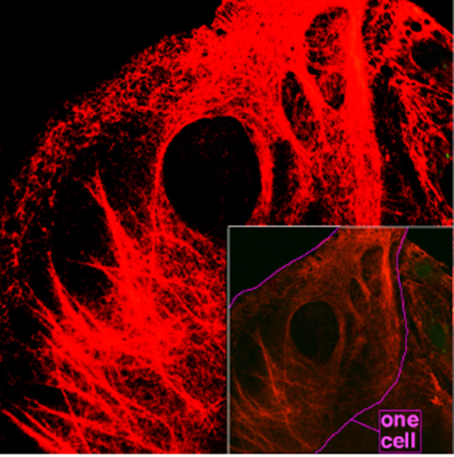 Microscopy of keratin filaments inside cells