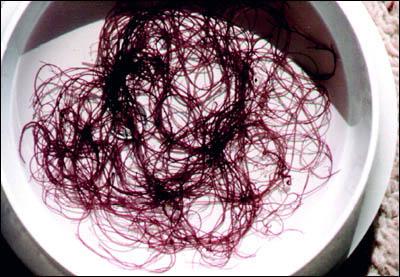 agarophyte