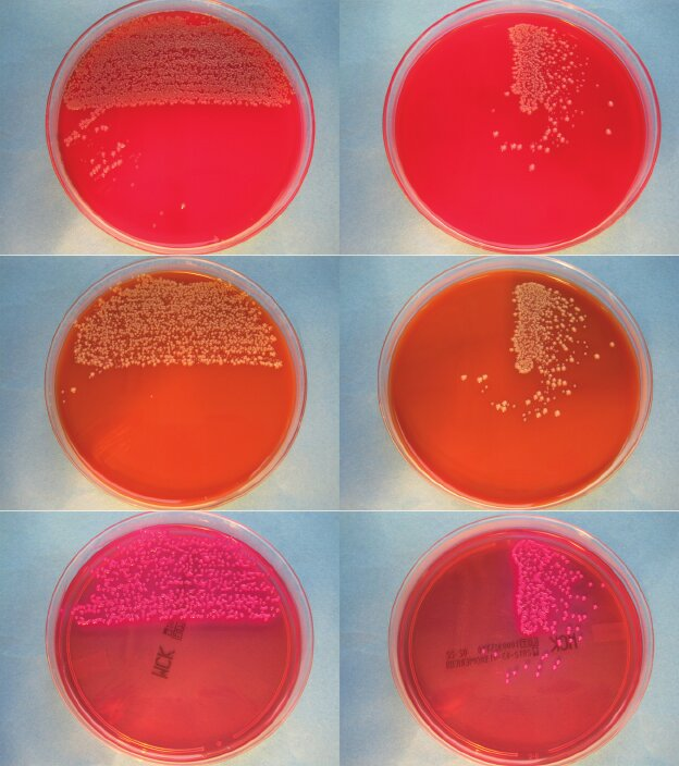 bacterial colony growth in agar